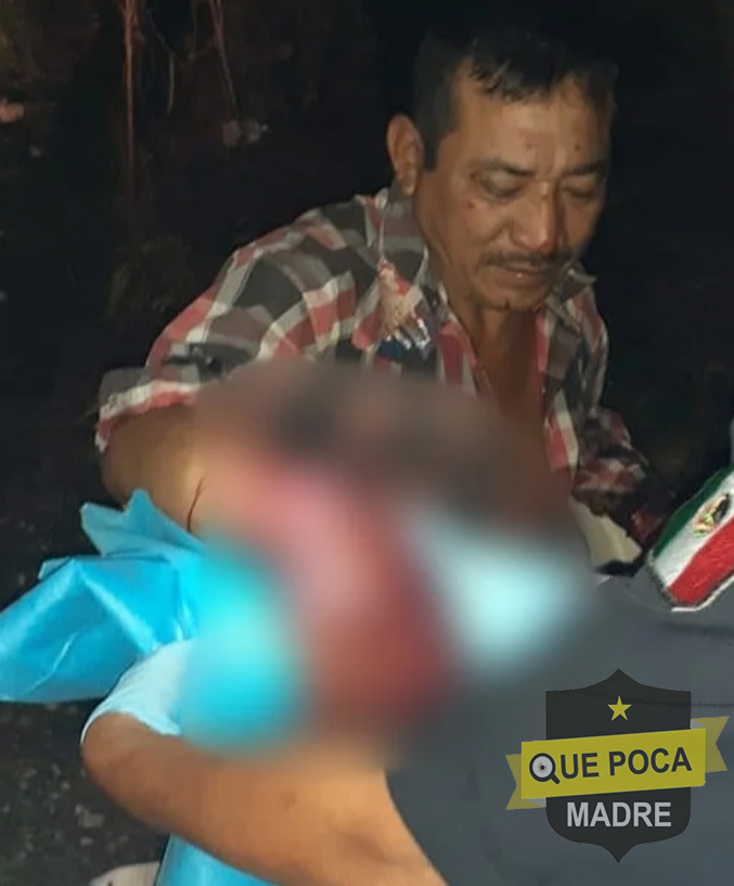 Hombre se dispara en la mano cuando iba a cazar en Umán.