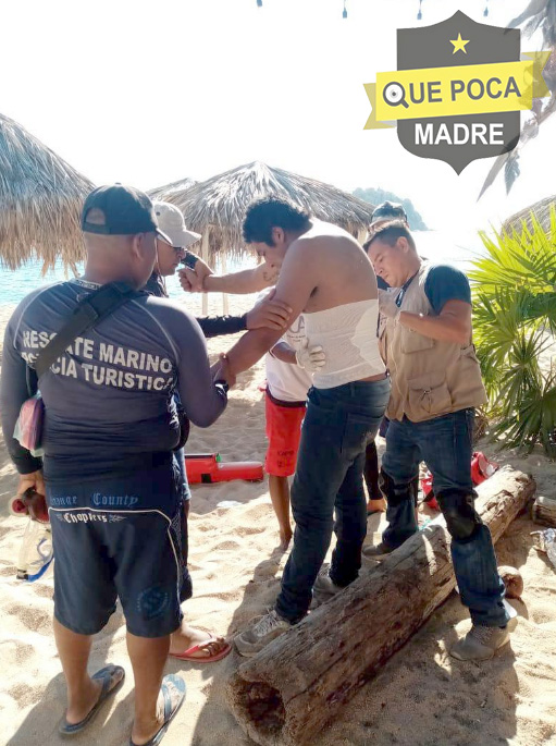 Machetean a un hombre en playa de Acapulco.