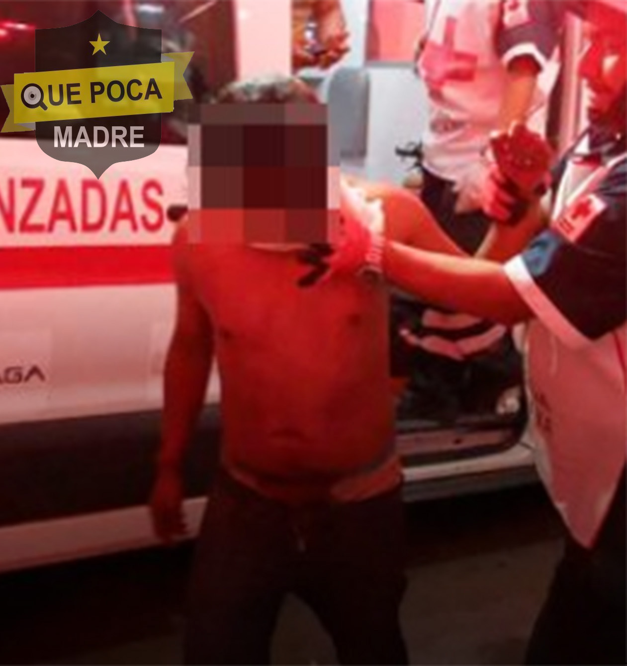 Navajean a joven en la cara durante riña en Colima.