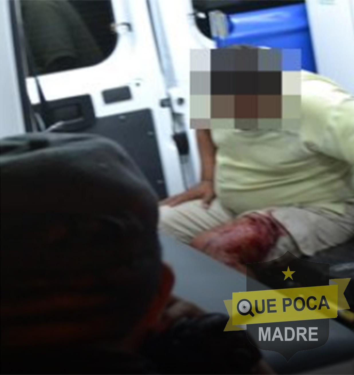 Hombre es baleado al entrar al rancho donde trabajaba sin avisar en Tenabo.