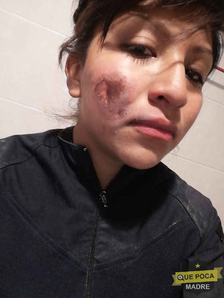 Mujer policía fue herida por petardo en marcha del día de la mujer en la CDMX.
