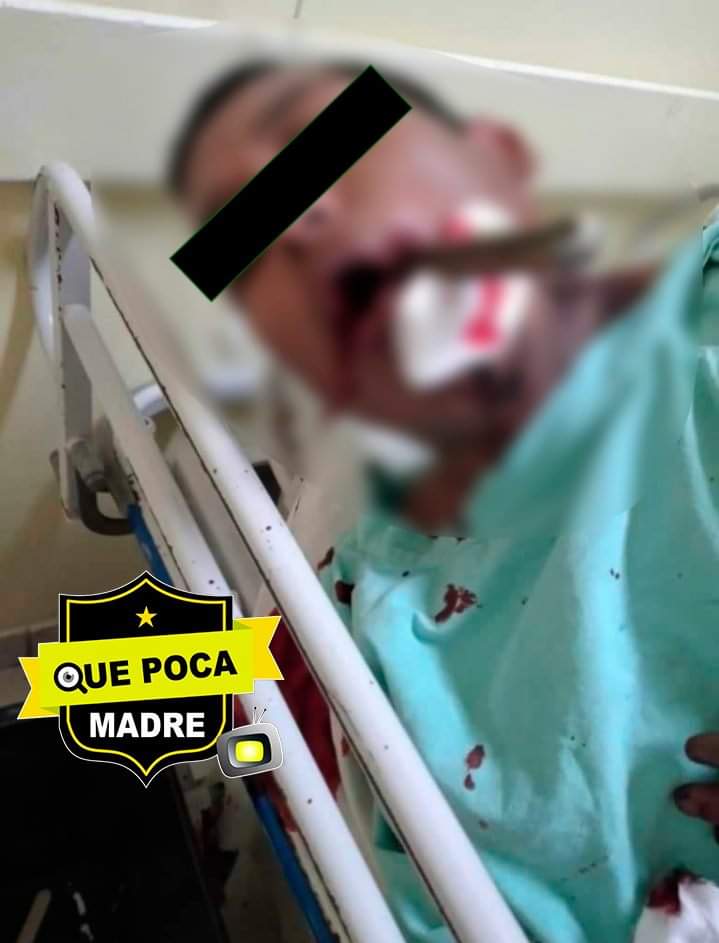 Sujeto es navajeado en la cara por su tío en Coahuila.