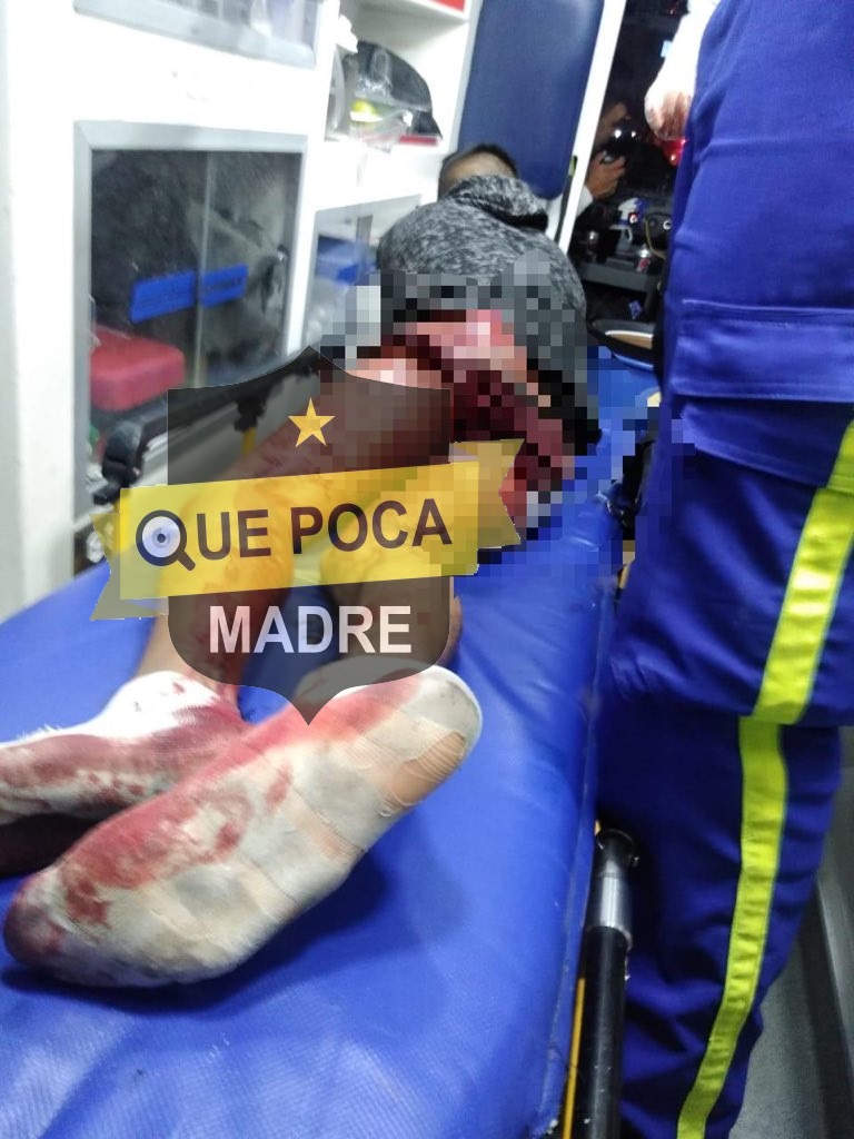 Pasajero se resiste a un asalto y le disparan en Los Reyes La Paz.