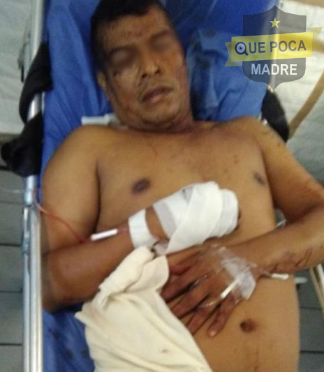 Matan a un hombre y hieren a su hermano durante ataque directo en Xochitepec.