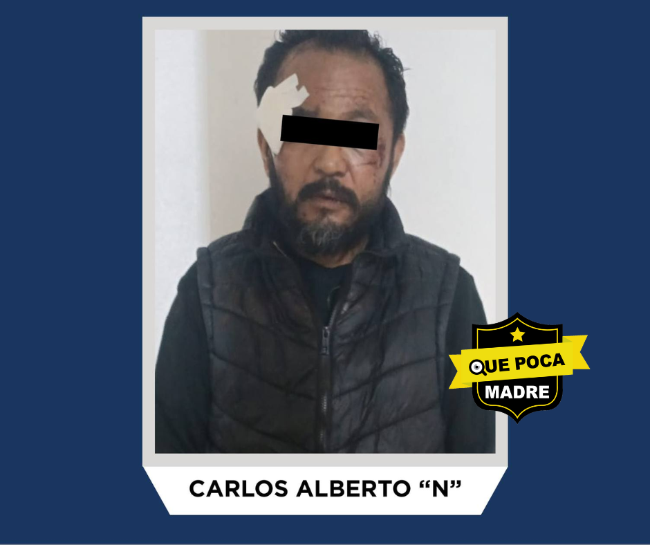 🚨‼CARLOS ALBERTO CHOCÓ SU AUTO CONTRA OTRO Y DEJÓ DOS LESIONADOS EN METEPEC ‼💥👮‍♂️