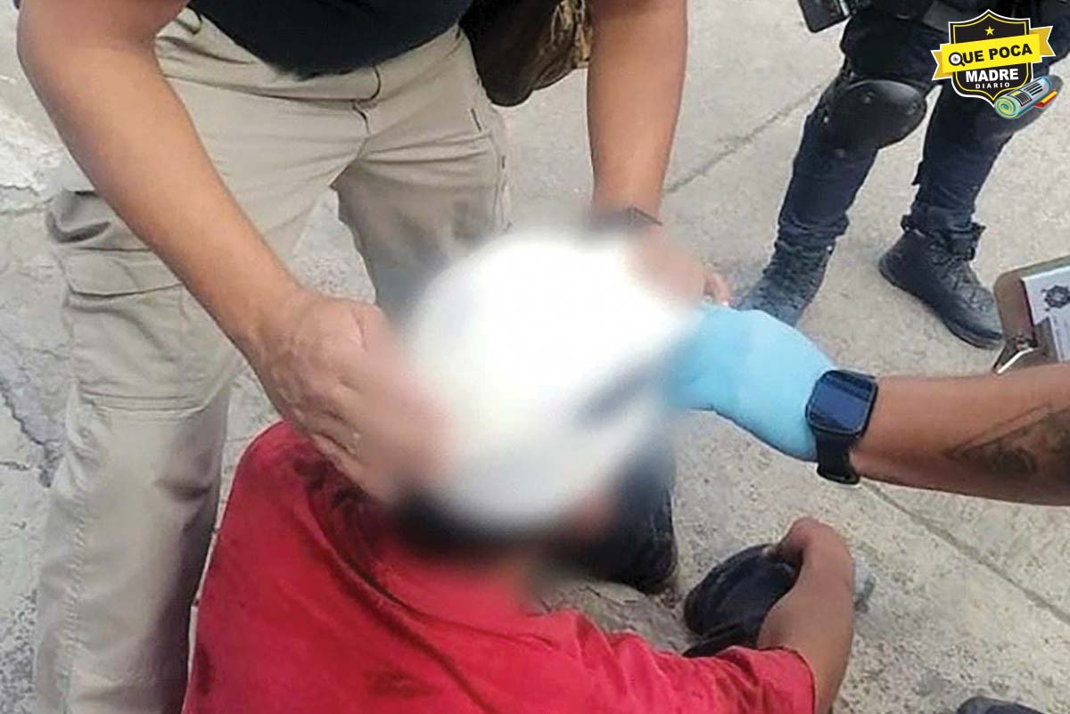 ¡COMO CLAVO! ¡A MARTILLAZOS! Joven es agredido severamente en Zamora