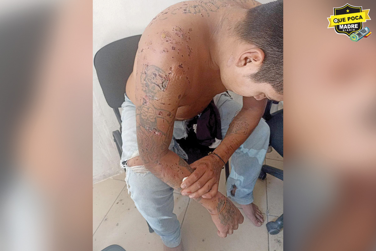 HOMBRE SE ESCAPA DE SUS SECUESTRADORES Y PIDE AYUDA EN CHIAPAS